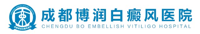 成都白癜风医院哪家好